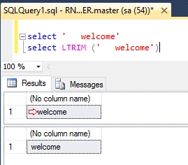 SQL Server