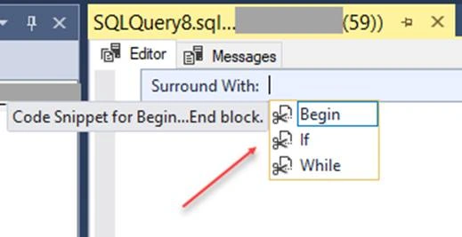 Quick SSMS Tip